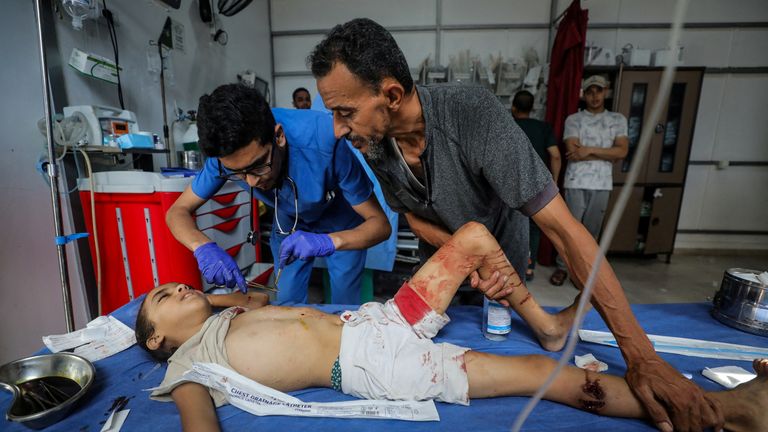 A wounded child is treated after the strike on the water collection point. Pic: Reuters