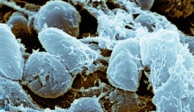Plague Death in Arizona Shows Insidious Disease Never Disappeared : ScienceAlert