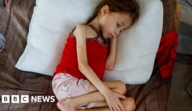 MPs call on government to bring sick and injured Gaza children to UK