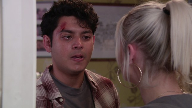 Aadi with a cut on his eyebrow crying to Lauren in Corrie