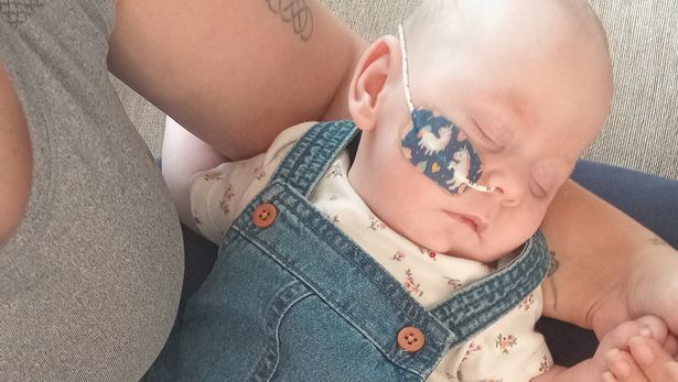 Baby Ellie who is on palliative care at Alder Hey