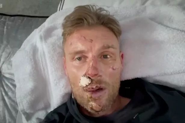 Freddie Flintoff sustained horrific injuries in a car crash while he filmed Top Gear in 2022