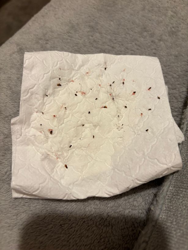 Emma says she has to clean fleas from Buster several times a day.