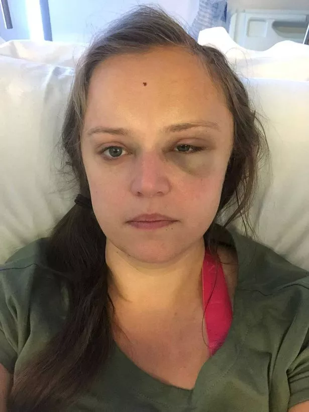 Kim Wilson, 37, was unable to speak properly and was disorientated when she crashed her car six years ago - but assumed she'd had a panic attack