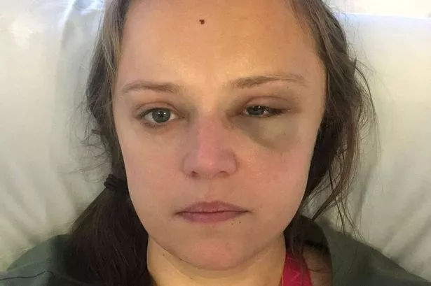 Kim WIlson in hospital following her tonic-clonic seizure