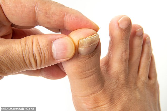 For any minor toenail issues it¿s best to see a private podiatrist, as NHS podiatry is reserved for those with very severe issues or particularly vulnerable patients