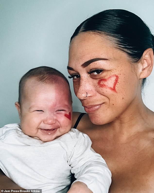 A mother who faced fierce criticism after using laser treatment on a large birthmark on her baby's face has revealed what he looks like three years later (pictured)
