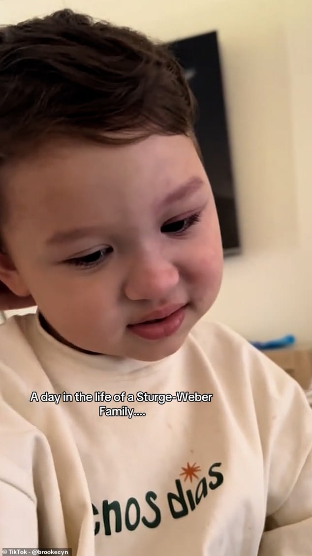 Port-wine stain birthmarks are usually harmless, but if on the face - particularly over the eye - they can be linked to glaucoma and Sturge Weber Syndrome - and as it turned out, Kingsley had both. Kingsley pictured in June this year