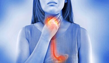 The most recognisable symptom of acid reflux is a burning sensation when stomach acid leaks up into the oesophagus and throat – which is why it’s often referred to as heartburn