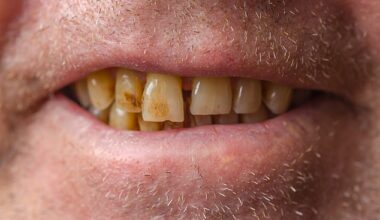 Yellow stains on teeth are common ¿ but they might not just be caused by drinking too much coffee (stock image)