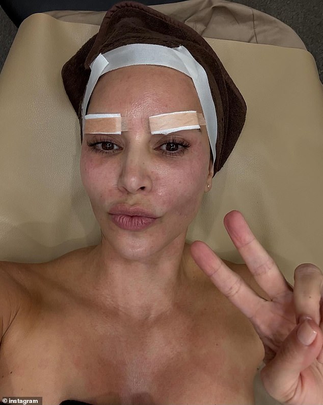 In this image she had gauze and Band-Aids on her eyebrows while flashing a peace sign