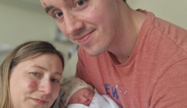 Gemma Small (pictured, with partner Ciaren), 31, of the town of Horwich, Greater Manchester, received the awful diagnosis just after little Samuel (pictured) was born in early February this year