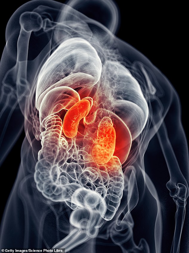 Diabetes is by far the biggest culprit of kidney disease, particularly in driving the most severe forms of the condition