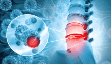 ​7 foods that weaken the bones​