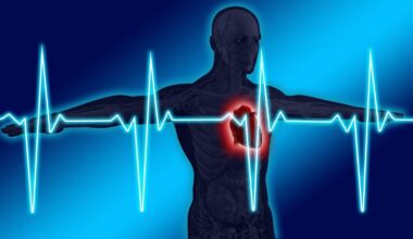 Cardiologist explains if exercise can help 'remove or prevent heart blockage' by reducing stress, lower blood pressure | Health