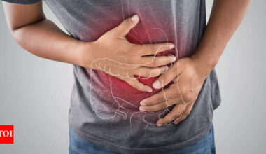 Bowel cancer on the rise: Experts reveal the hidden factor that increases the risk of colorectal cancer |
