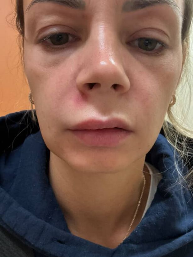 Alisha after popping the spot (Jam Press)