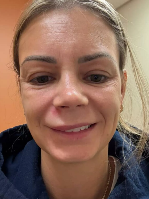 Alisha's face after she went to hospital