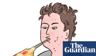Is it true that … eating greasy food causes spots? | Health & wellbeing