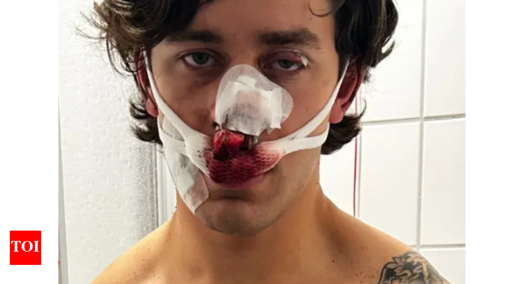 US man stabbed in Germany: 21-yr-old NY model severely injured while trying to save 2 women from local thugs; who is John Rudat? | World News