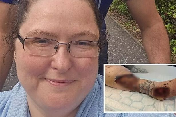 Louise Gourlay suffered a nasty injury, leaving her "stripped" of her independence 