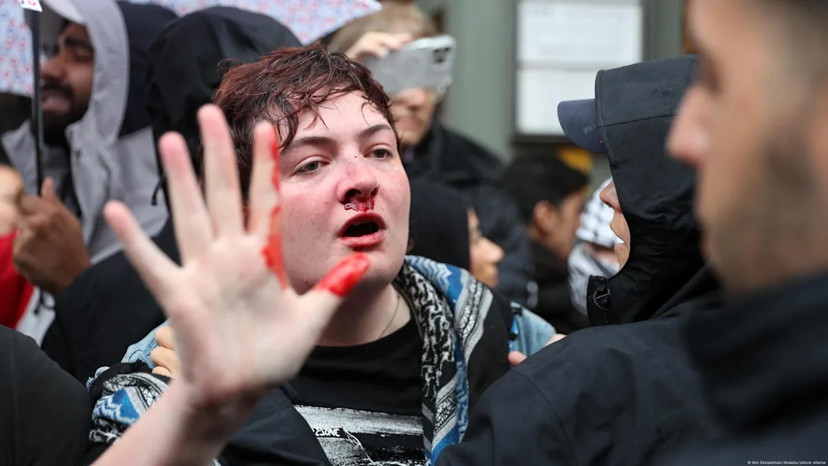 Ireland voices concern over Berlin police violence