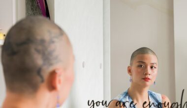 The 29-year-old who spent 12 years grappling with a hair-pulling disorder and finally shaved it all off
