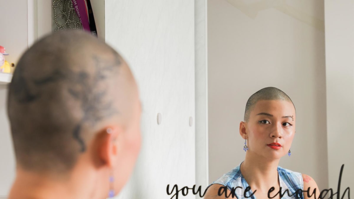 The 29-year-old who spent 12 years grappling with a hair-pulling disorder and finally shaved it all off