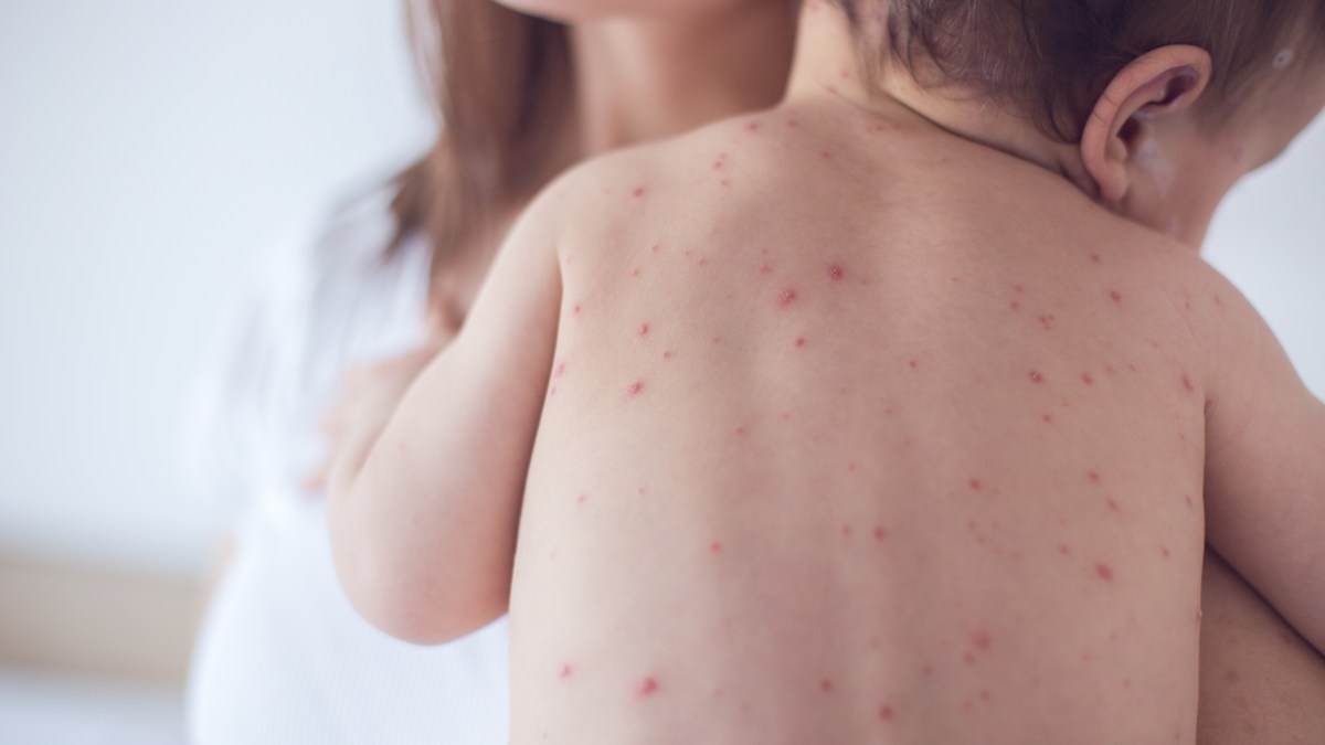 NHS to roll out jab to all children next year