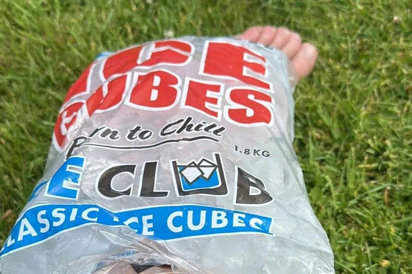 A pack of ice cubes on a person's leg
