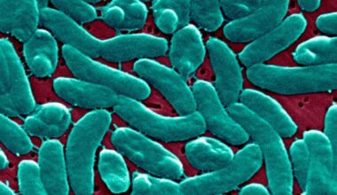 Horror flesh-eating bacteria disease breakout confirmed in Florida and Louisiana | World | News