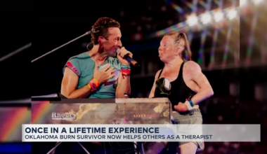 Oklahoma burn survivor turned therapist shares her inspiring journey