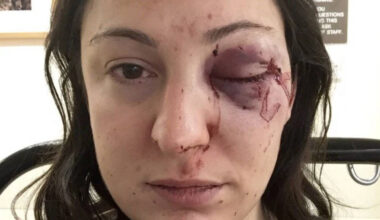 'Every system that should have helped me failed': Victim slams police response after being attacked for confronting shoplifters