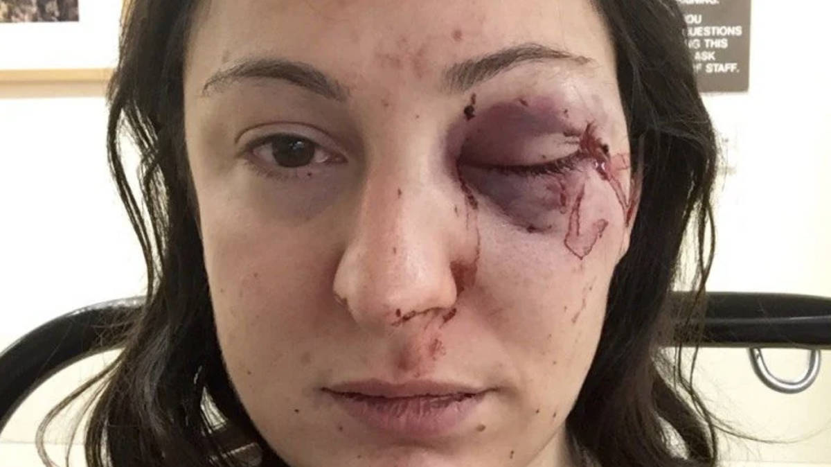 'Every system that should have helped me failed': Victim slams police response after being attacked for confronting shoplifters
