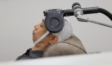 Non-invasive depression treatment TMS has helped engineer get his life back