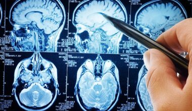 Until now, dementia diagnoses often rely on questionnaires to indicate problems with memory as well as MRI scans (pictured) to track loss of brain volume
