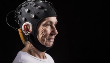 A woman models an example of the transcranial direct current stimulation cap used in the recent study by researchers at Hebrew SeniorLife. The cap used in the recent study had fewer electrodes on it.