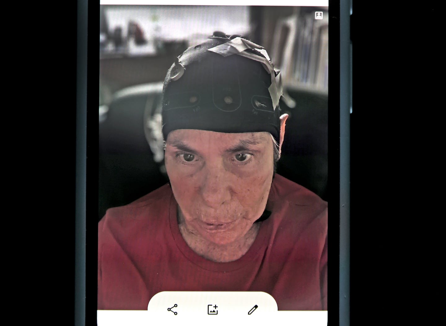 Mimi Katz took a self-portrait from her cellphone of her wearing a brain stimulation device when she participated in a recent trial testing electrical brain stimulation to increase motivation for working out among older adults.
