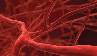Genetic Study Reveals Subtypes in Common Blood Cancer