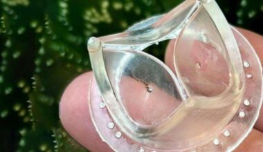 Plastic heart valve being developed by University of Cambridge and University of Bristol ‘could help millions of patients’