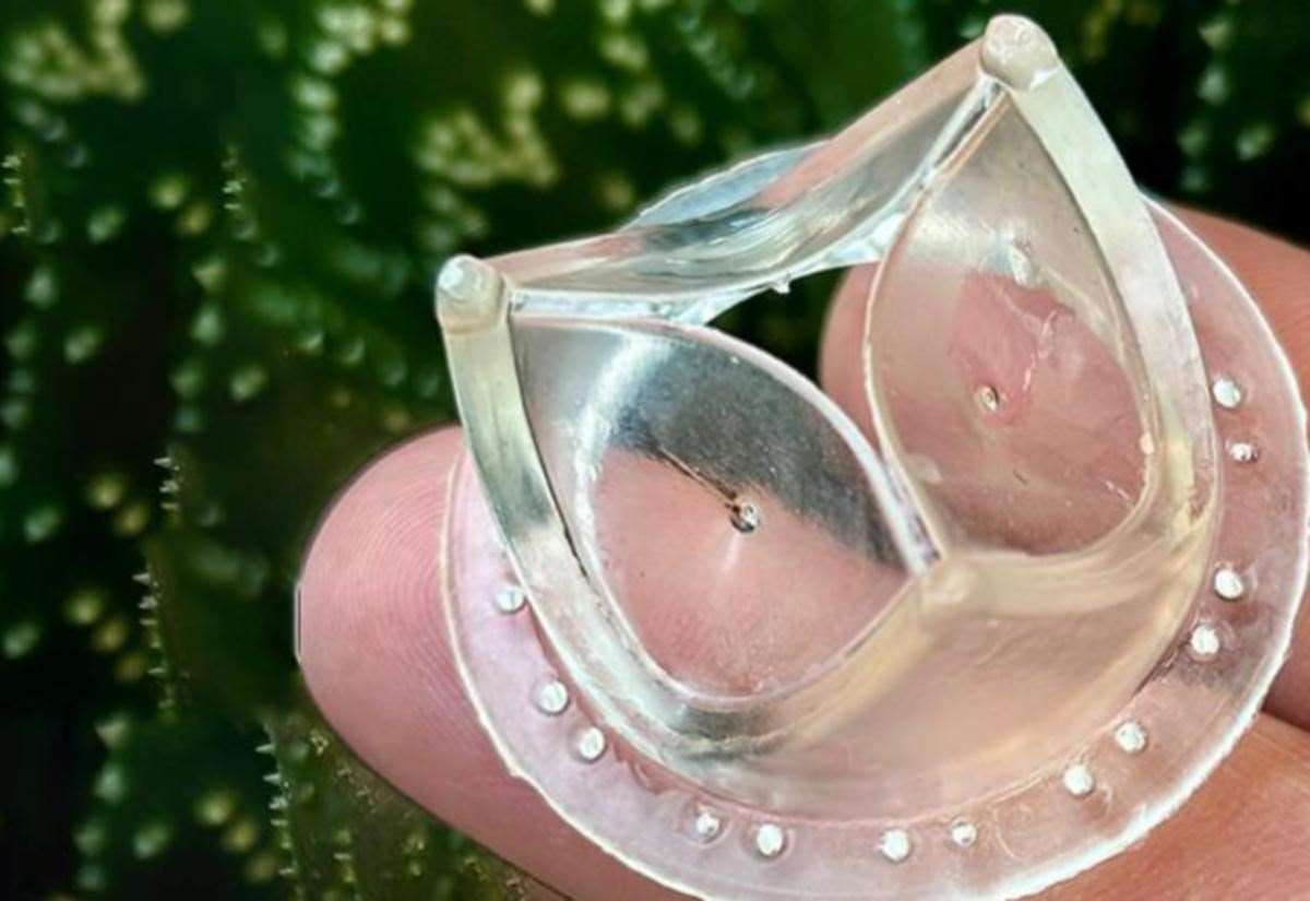 Plastic heart valve being developed by University of Cambridge and University of Bristol ‘could help millions of patients’
