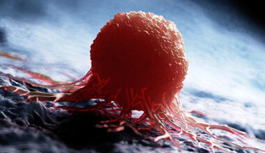 'Universal' Cancer Vaccine Destroys Resistant Tumors in Mice : ScienceAlert