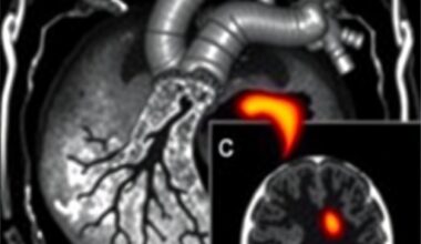 Genetics and Cardiac MRI Predict Pediatric Nonischemic Heart Failure
