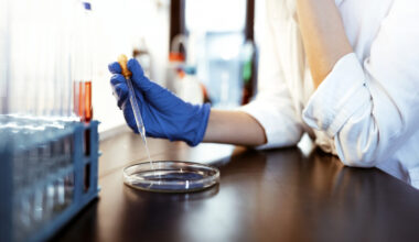 female scientist examining microbiome culture plate.