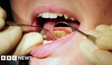 Overhaul to Manx NHS dental contracts 'could slash wait times'