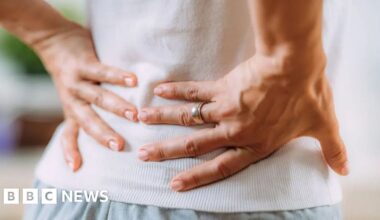 AI app halves wait list for back pain physio in Cambridgeshire