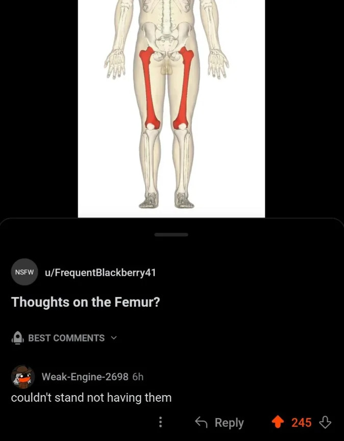 Diagram of a human skeleton highlighting the femurs in red. A humorous comment below reads, "couldn't stand not having them."