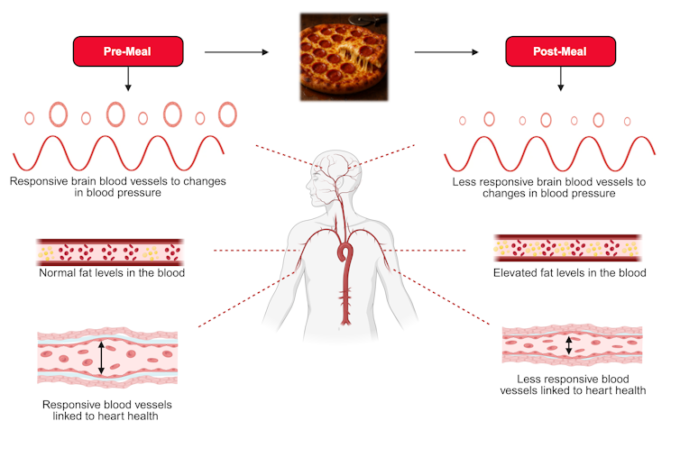 An illustration depicting stiff arteries and a sluggish brain.