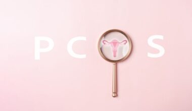 Genetic Variants Found To Drive PCOS Hormone Imbalance