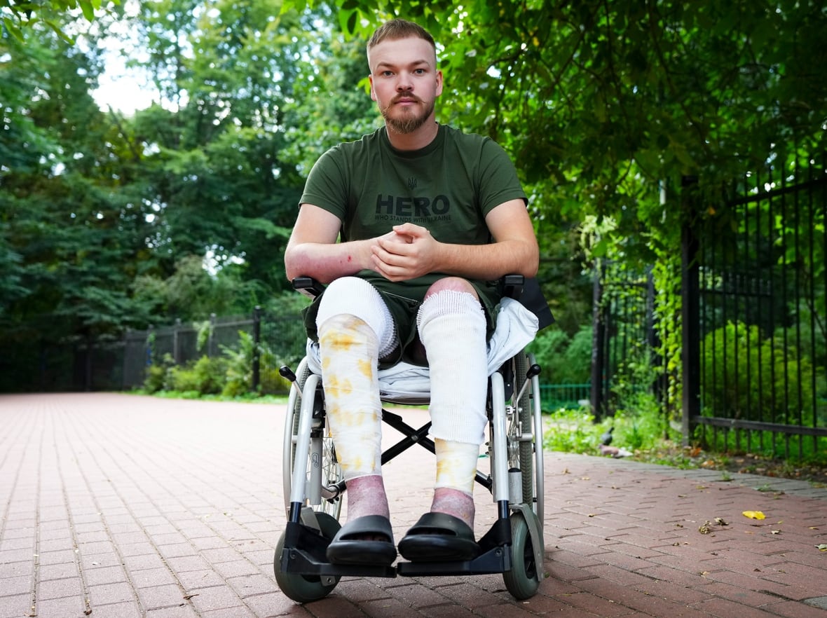 A man in a green T-shirt is pictured in a wheelchair.